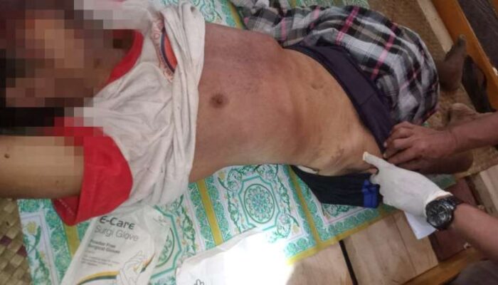 Seorang Pria Di Temukan Tak Bernyawa, Keluarga Korban Tolak Lakukan Otopsi