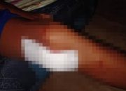 Pelajar 13 Tahun di Una Una Digigit Buaya Saat Mandi di Laut