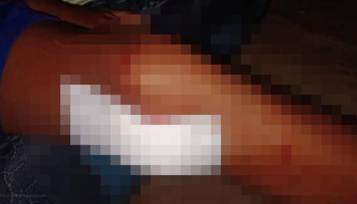 Pelajar 13 Tahun di Una Una Digigit Buaya Saat Mandi di Laut