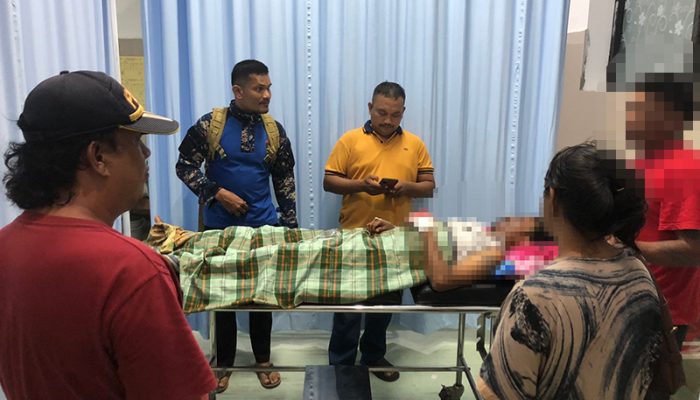 Bom Ikan Rakitan Meledak Sebelum Dilempar, Nelayan Touna Kritis dengan Luka Wajah